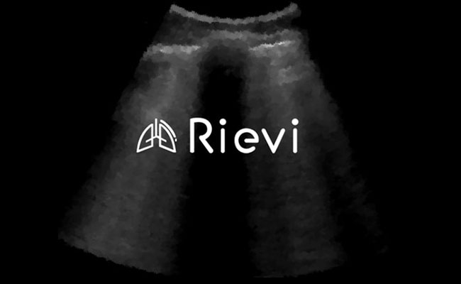 Yapay Zeka ile Akciğer Ultrasonu Yorumlama